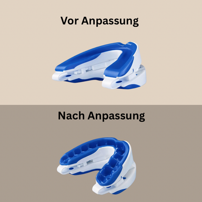Anti Snoring Mouthpiece – reduziert Schnarchen für ruhigen Schlaf