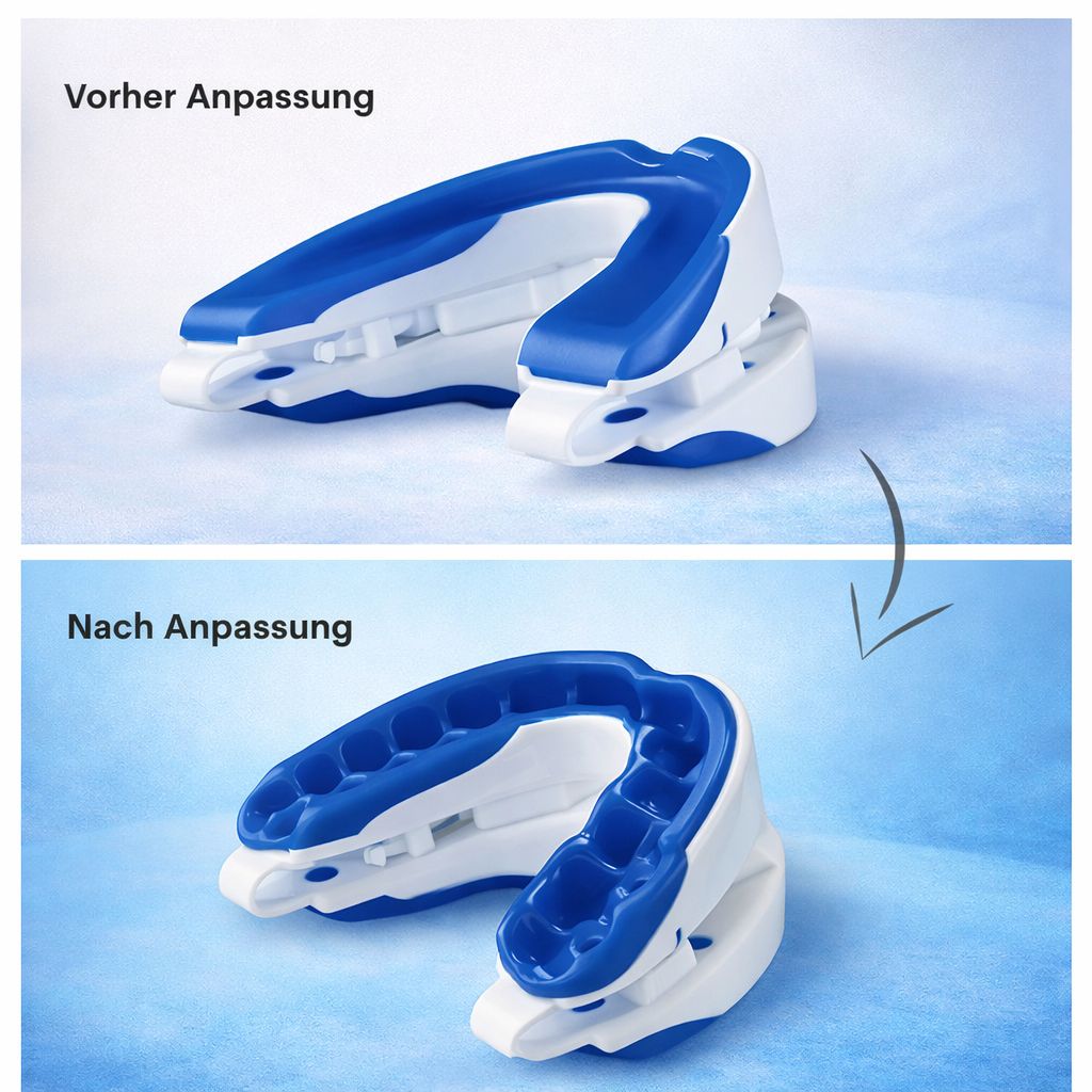 Anti Snoring Mouthpiece – reduziert Schnarchen für ruhigen Schlaf