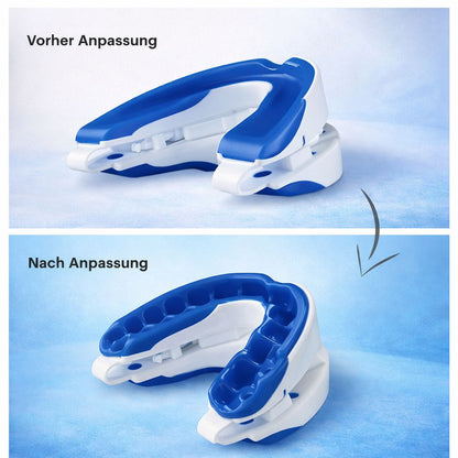 Anti Snoring Mouthpiece – reduziert Schnarchen für ruhigen Schlaf